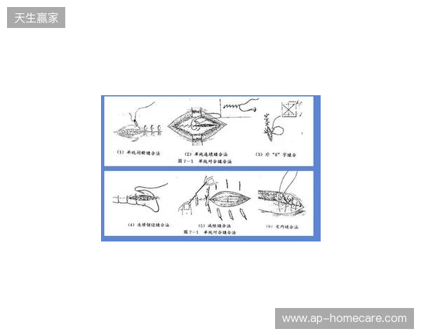 广州豹官方：杨浩眉弓伤口缝合30余针，预计5-7天后拆线